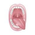 Swelling in the tongue. Wide open mouth.